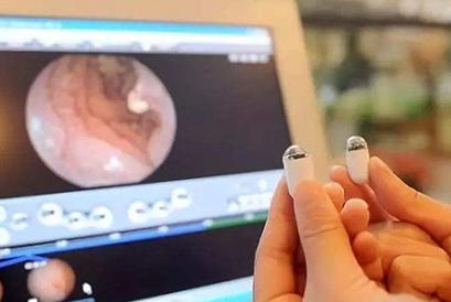 守“胃”健康体检套餐